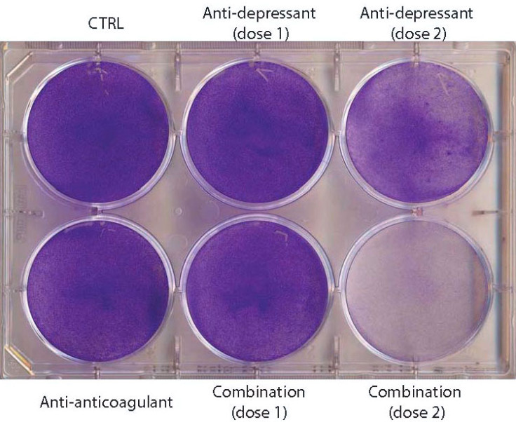 human glioblastoma cells