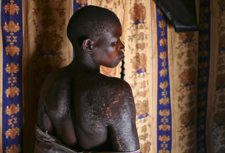 Victim of DRC armed groups and rebels