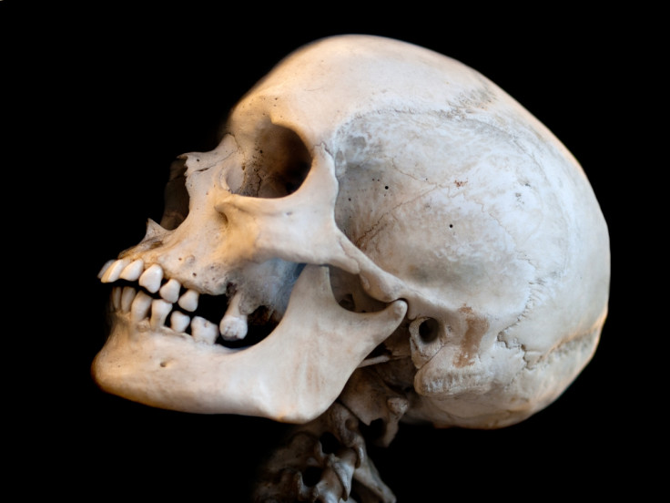 human skull