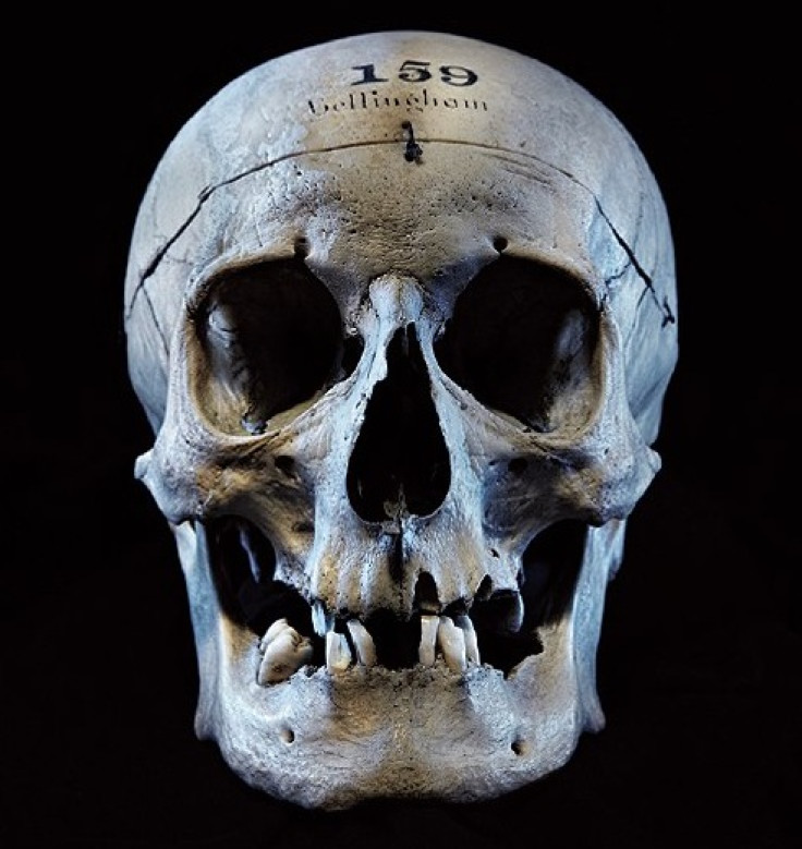 Skull of John Bellingham