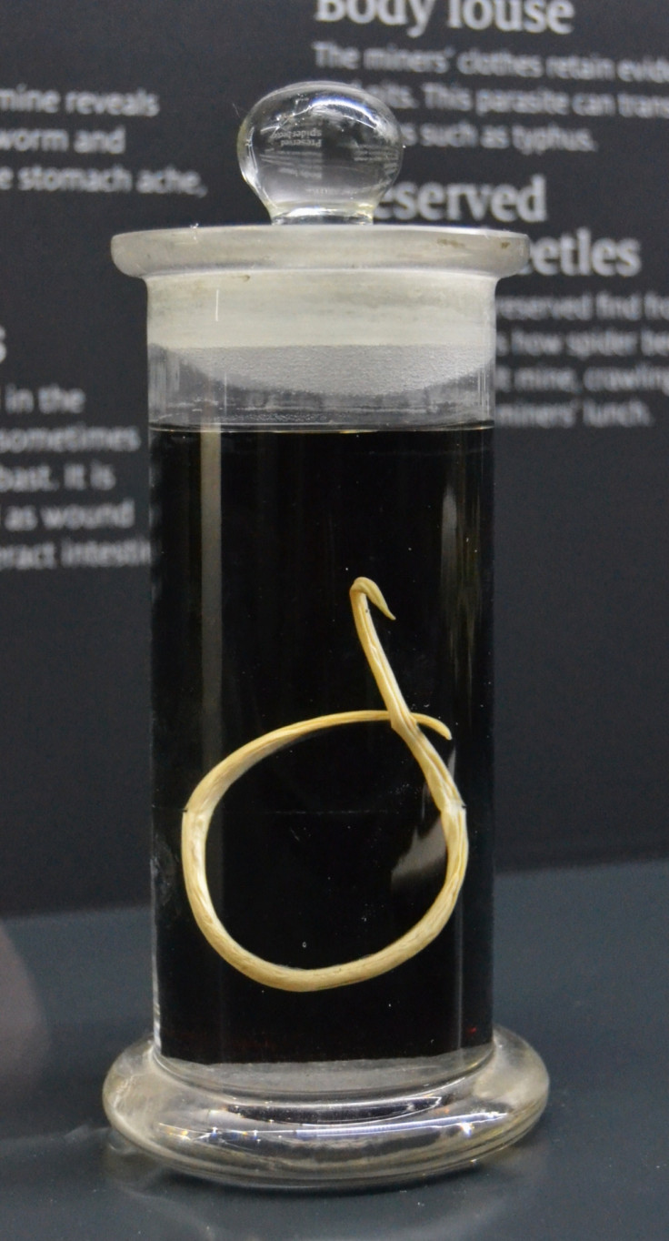 giant roundworm