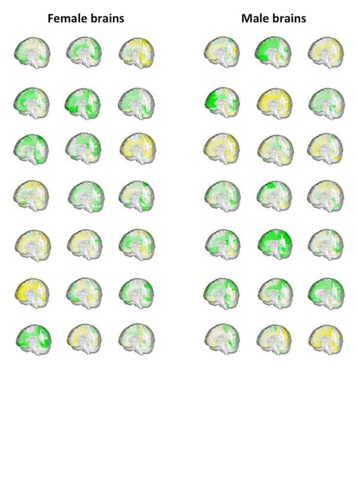 male and female brain differences