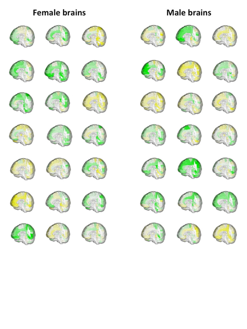 male and female brain differences