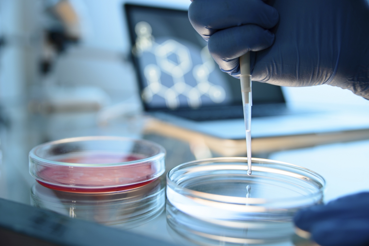 petri dish petri dish