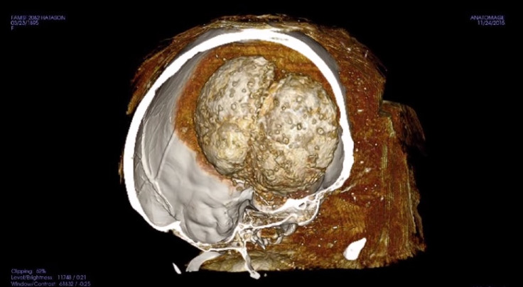 ct scan ancient egyptian mummy