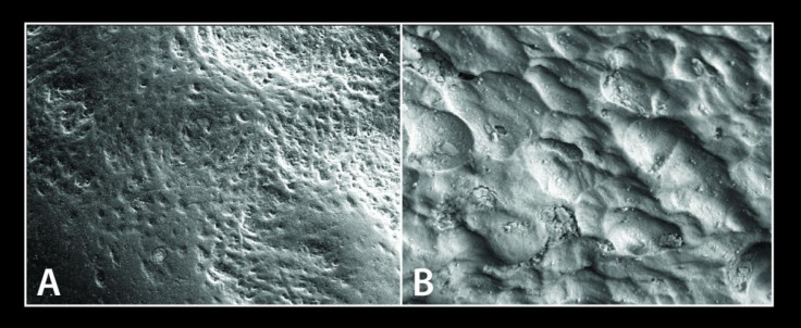 Osteoclast cells and osteoblasts