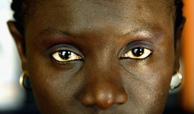 Salimata Knight, a survivor from Genital Mutilation