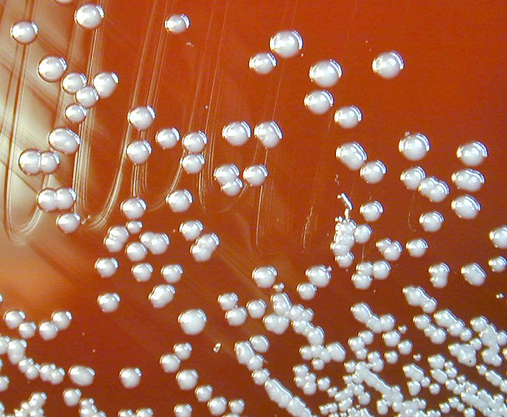 Burkholderia pseudomallei Melioidosis