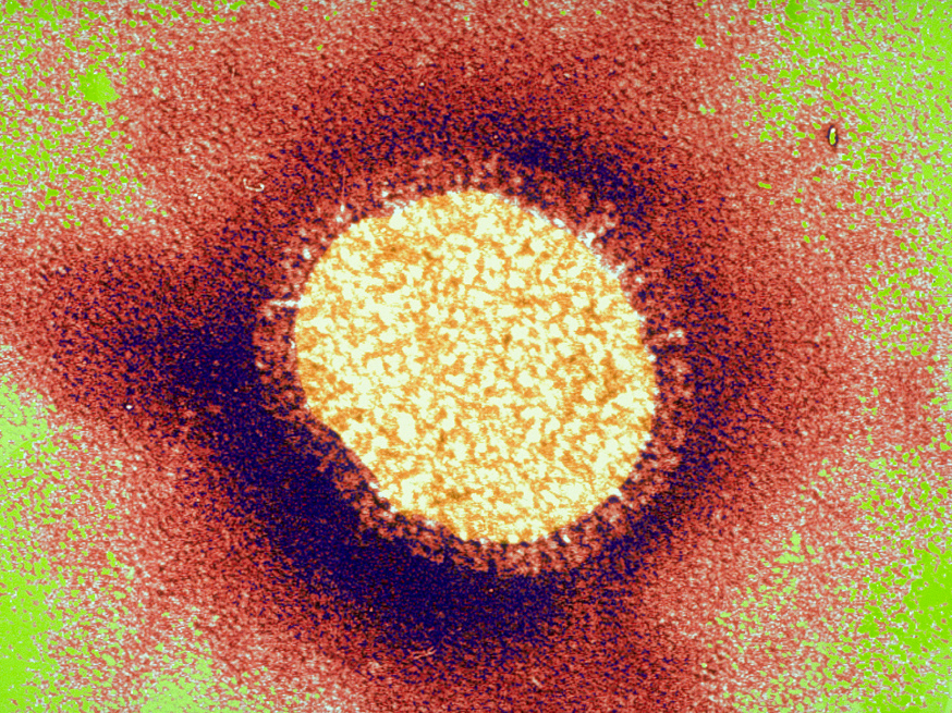Man flu? Women deal with influenza virus better than men ... - 874 x 655 jpeg 1053kB