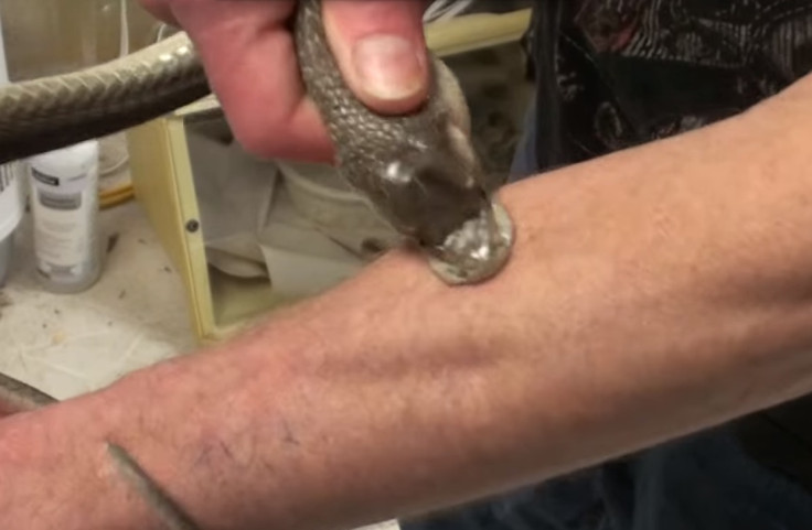 Black Mamba bite