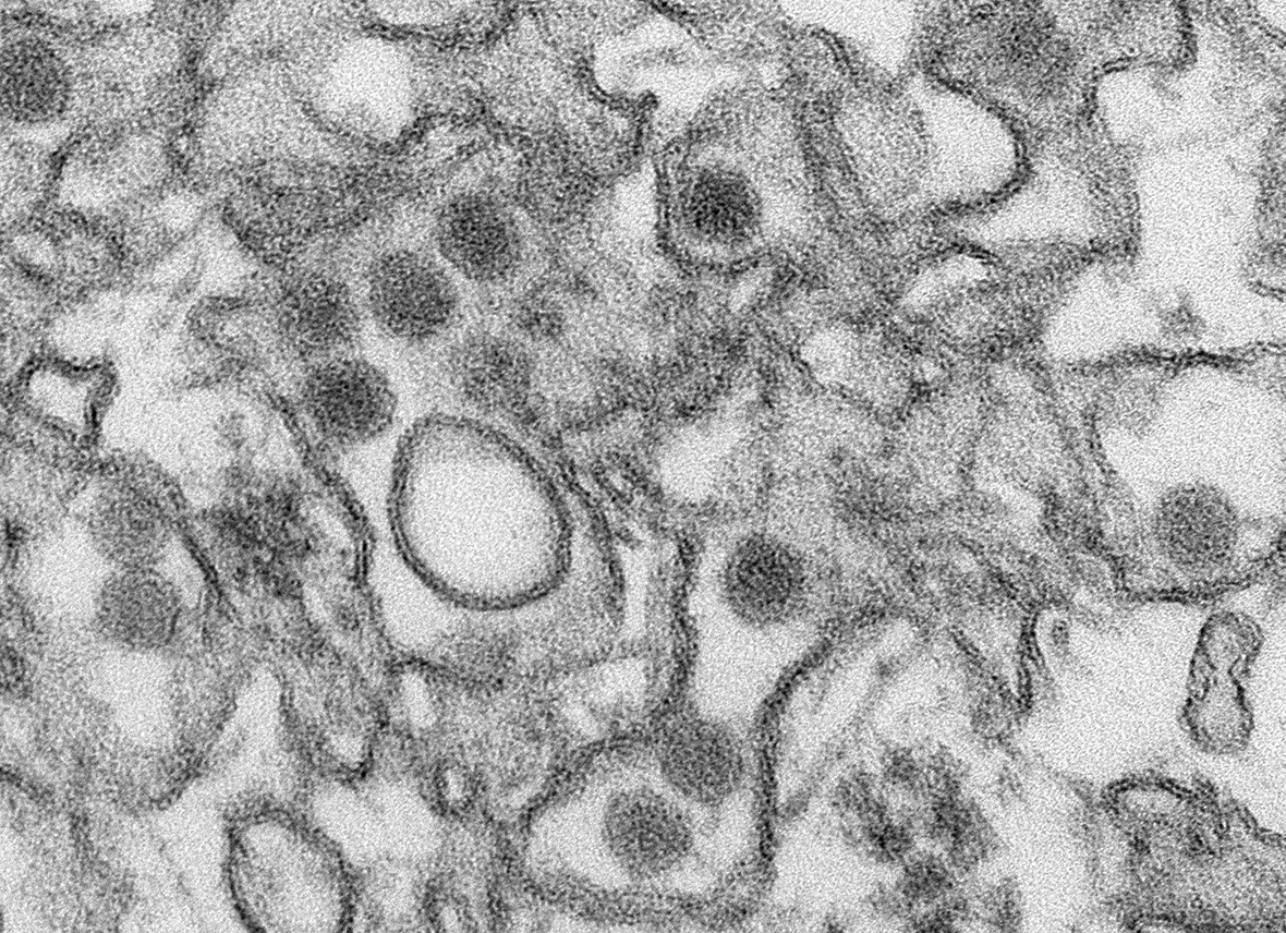 zika virus