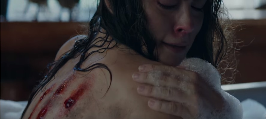 First Trailer For Cabin Fever Remake Offers Up Some Very