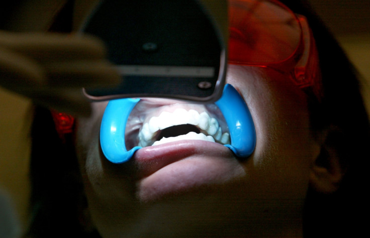 Teeth whitening