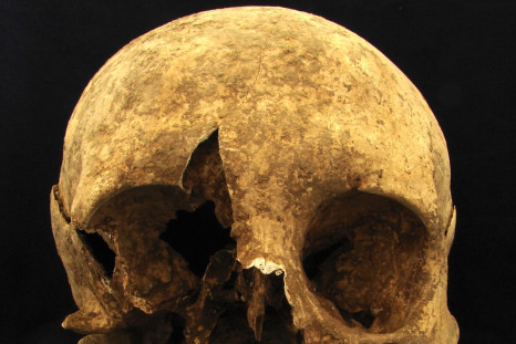 Excavated skull