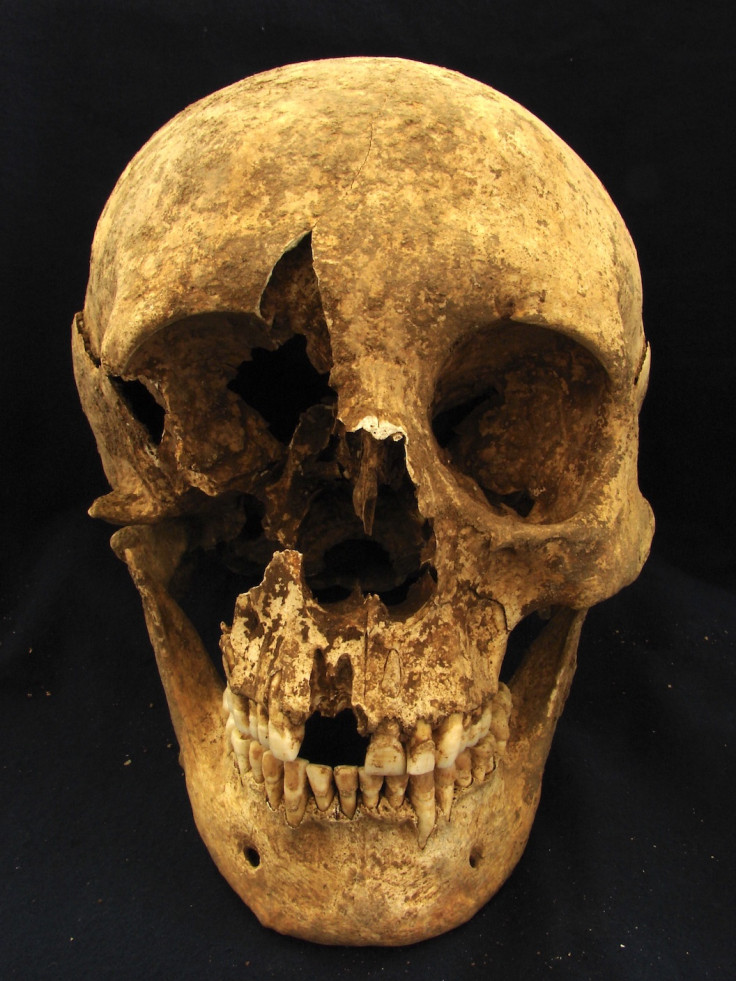 Excavated skull