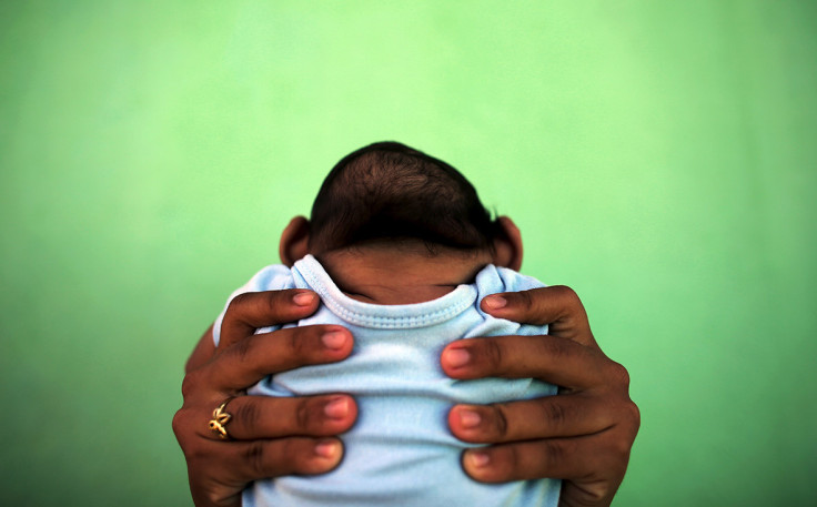 zika microcephaly