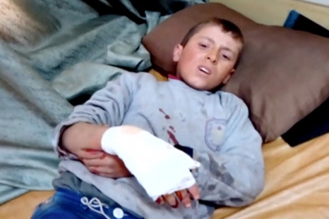 A boy lies on a bed with an injured hand