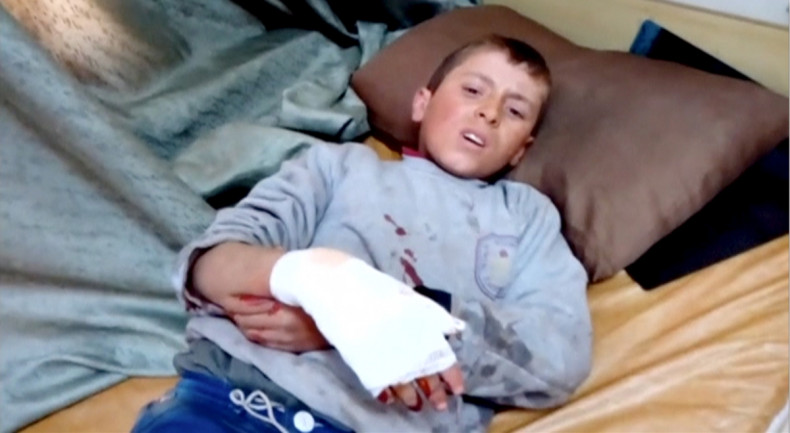 A boy lies on a bed with an injured hand