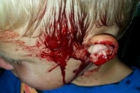 Boy attacked by snake 2