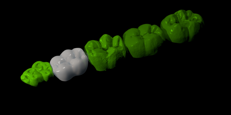 Model image of recreated teeth