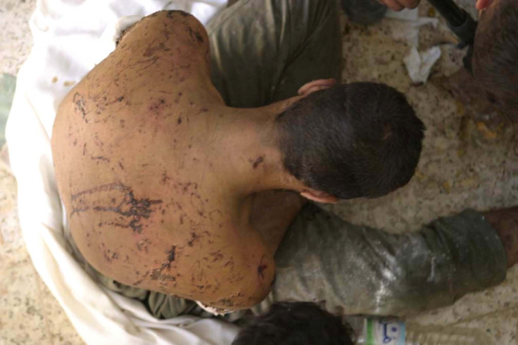 Iraq torture