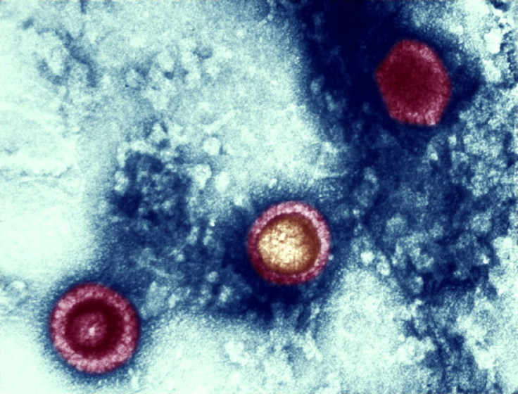 herpes virus