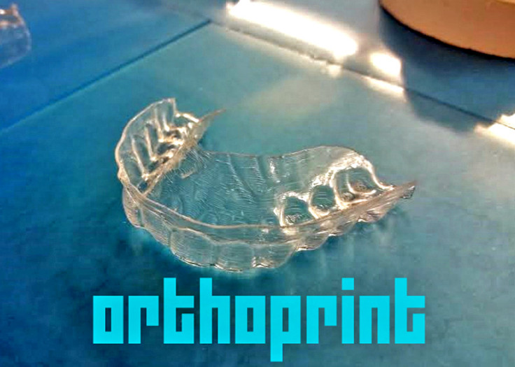 3D printed clear aligner braces
