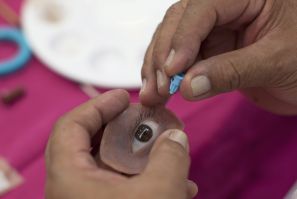 A doctor plants eyelashes on an ocular prosthesis for a social programme benefiting those unable to afford...