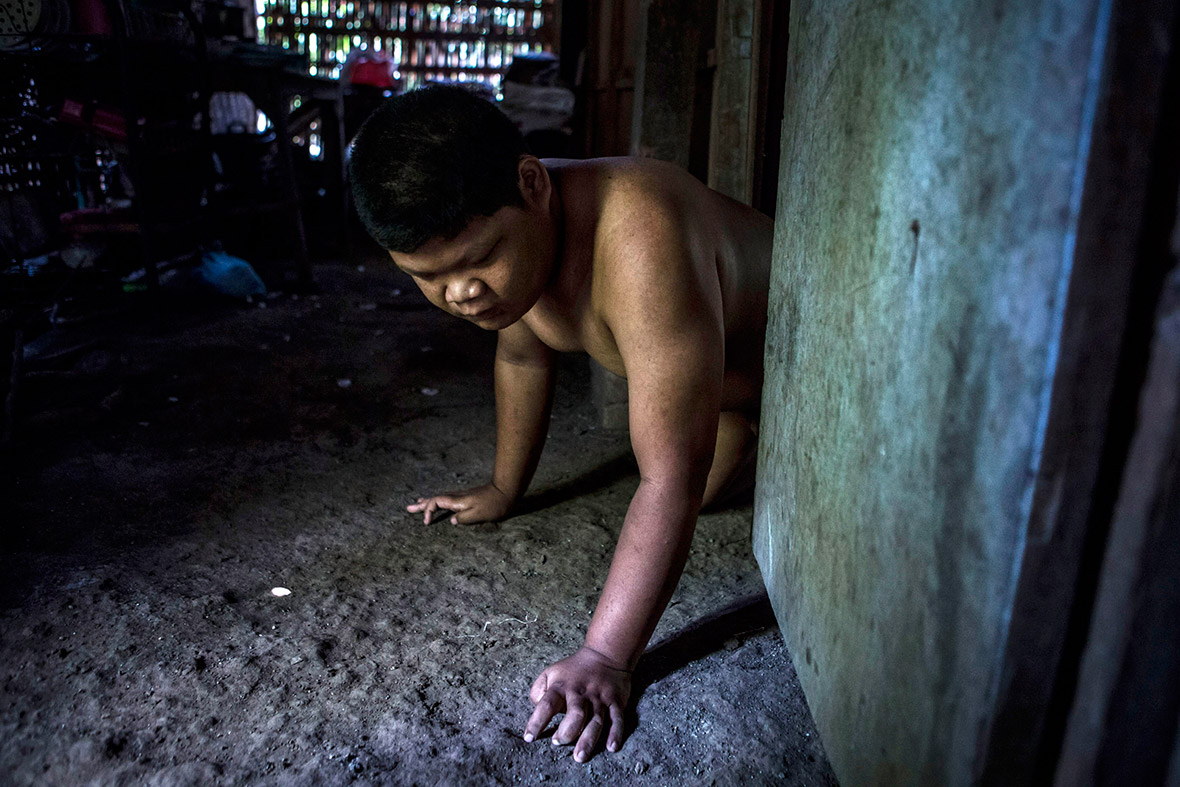 Indonesia mentally ill shackled