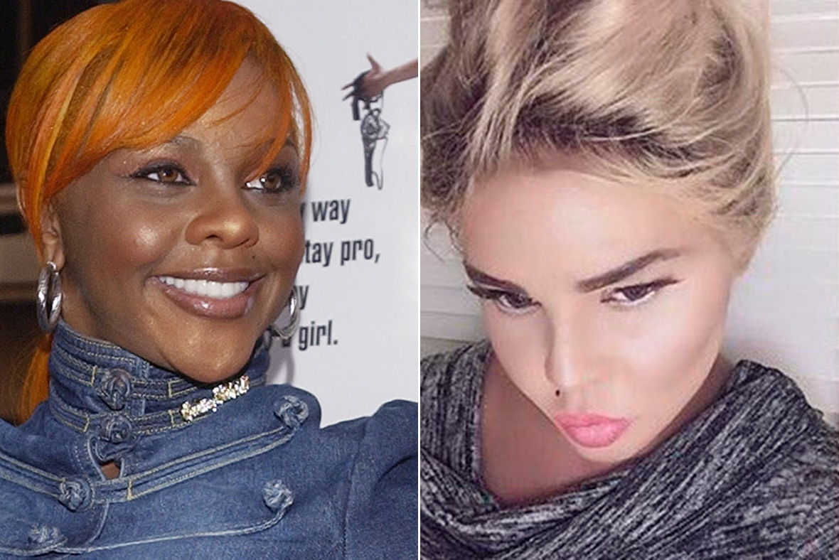What has happened to Lil' Kim's face? Plastic surgeons weigh in after