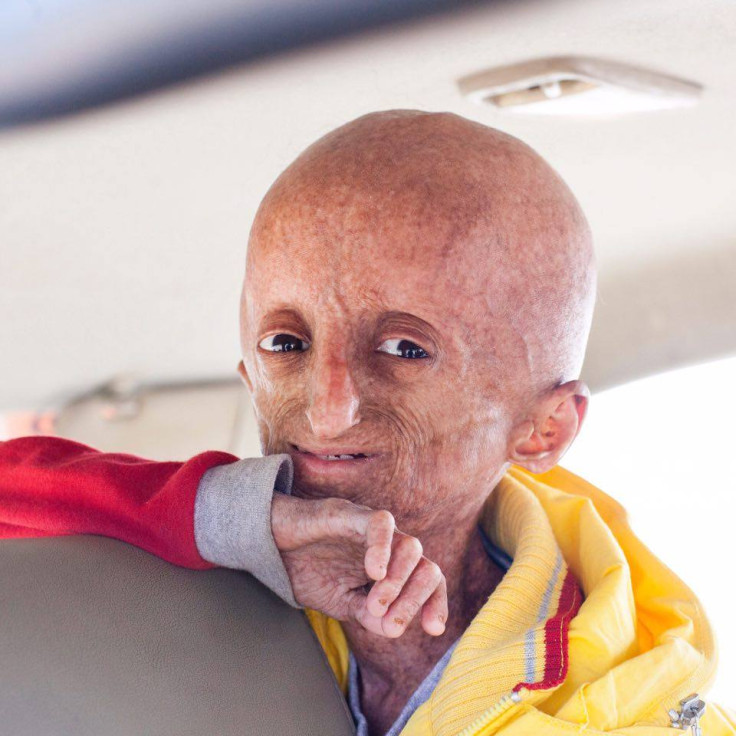 India progeria Nihal Bitla