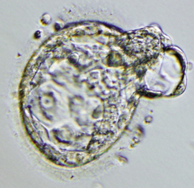 Human embryo