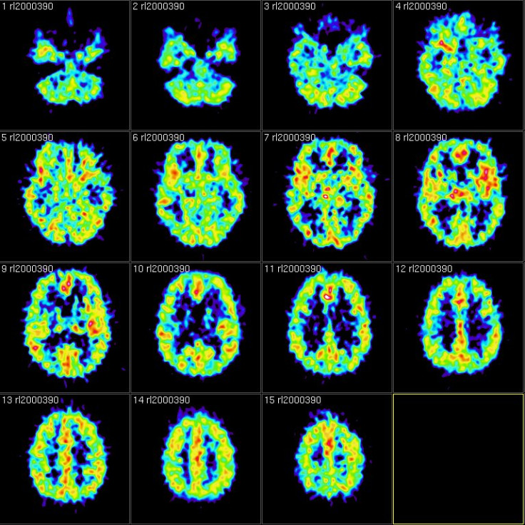 fMRI scans