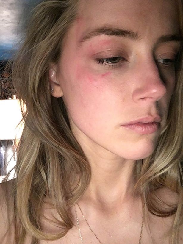 Amber Heard gives detailed account of alleged abuse during 15-month