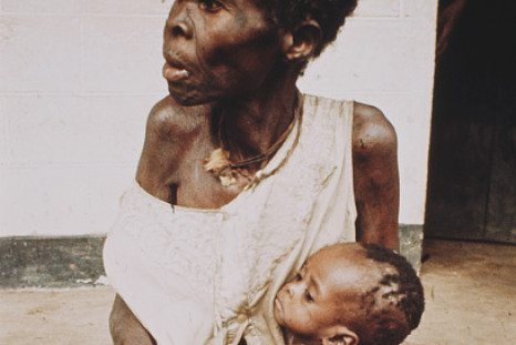Starvation during 1967-1970 Biafran war