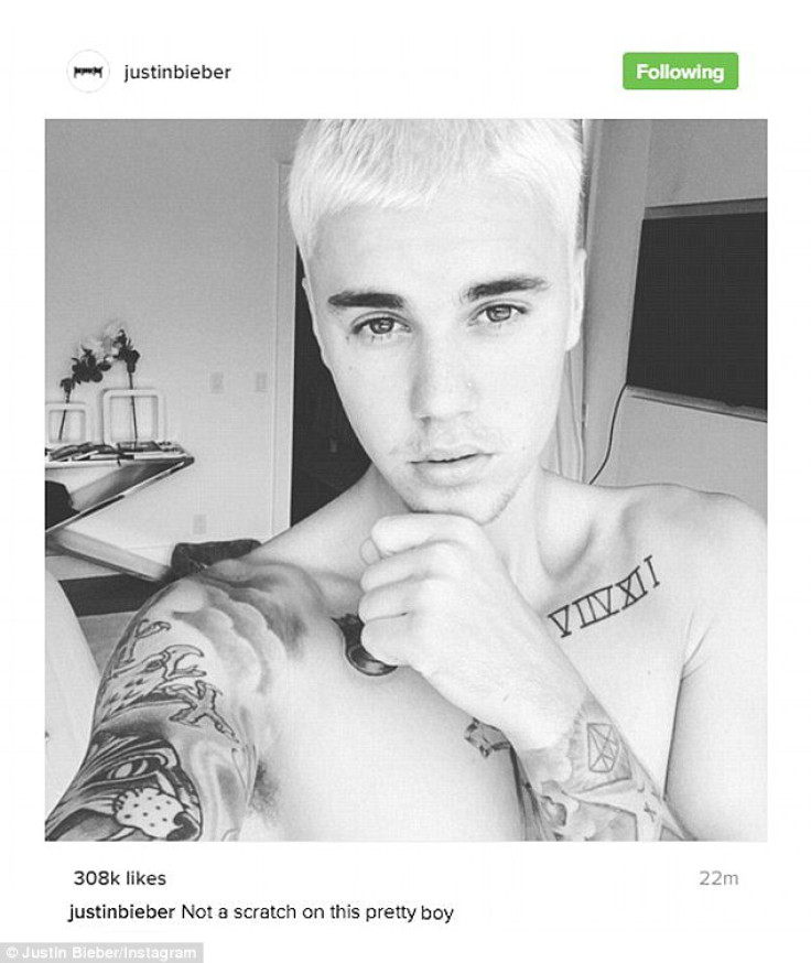 Justin Bieber posts a photo following fight