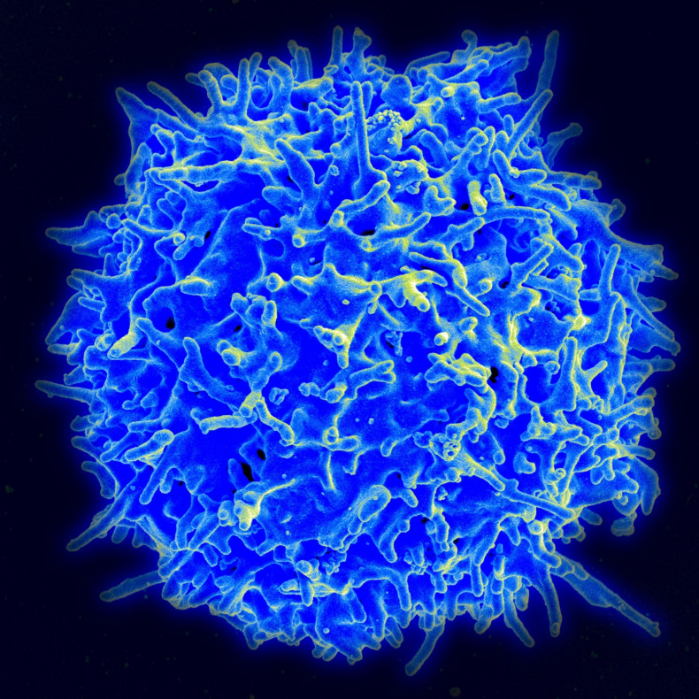 autoimmune disease T cell