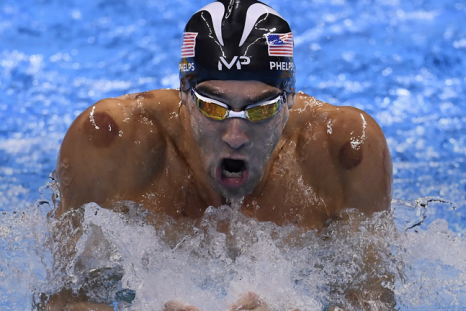 What actually is the the Olympic craze 'cupping'?