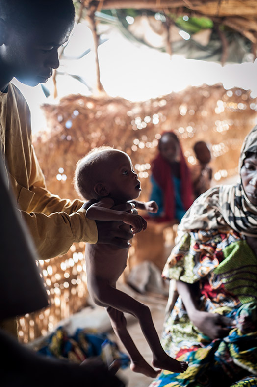 Nigeria Borno malnutrition Lake Chad