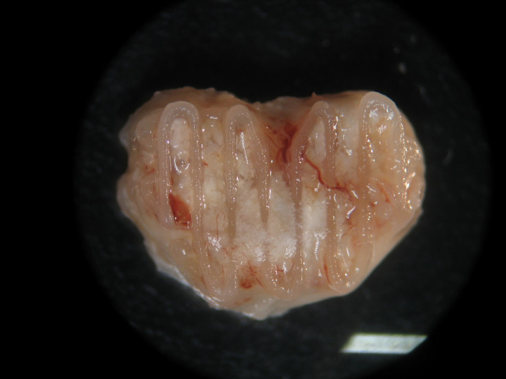 3D printed bone vertebral body