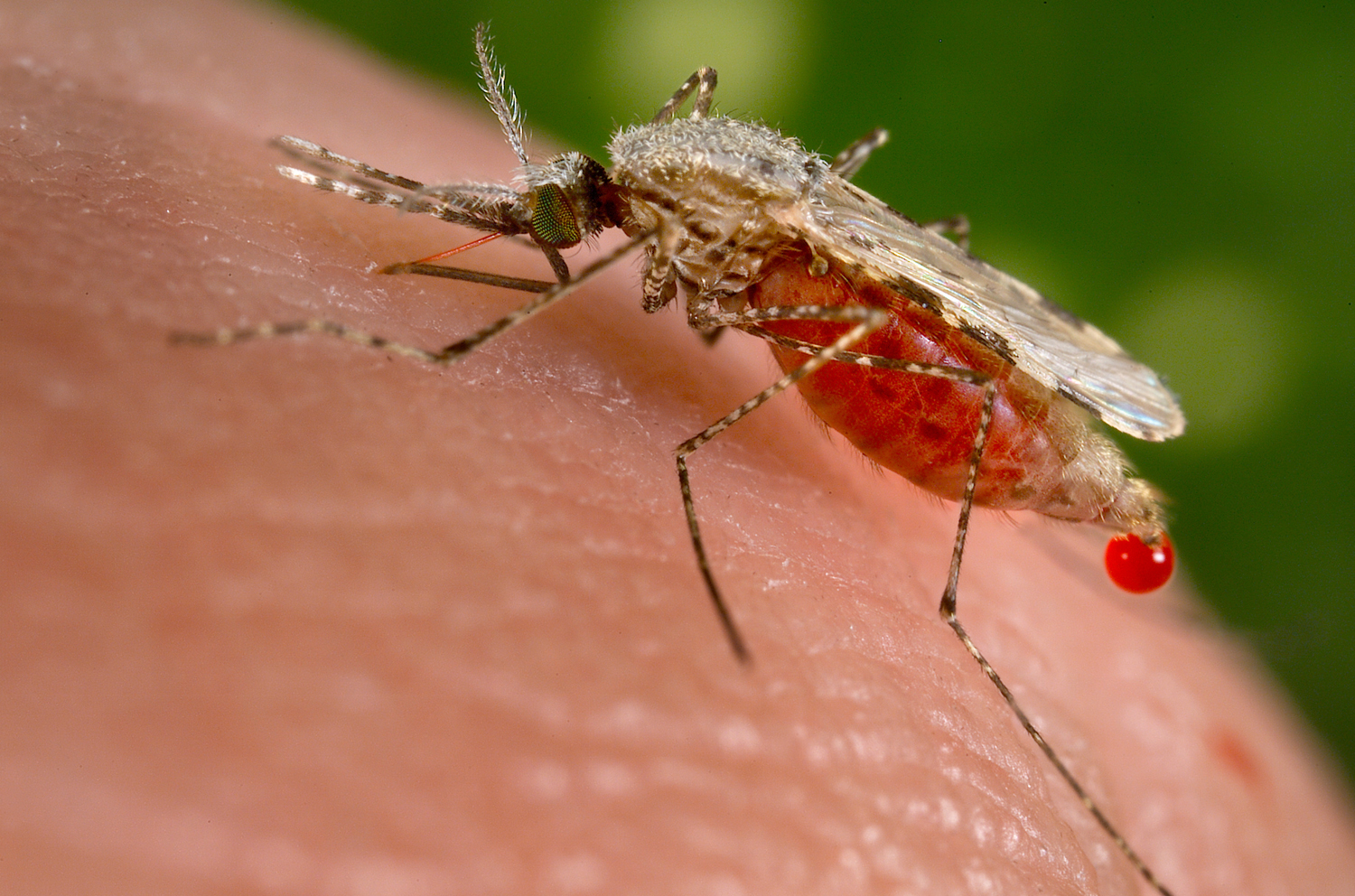 malaria-patients-who-resist-infection-provide-clues-to-come-up-with