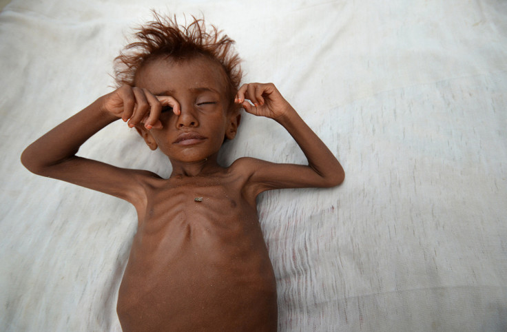 Yemen famine