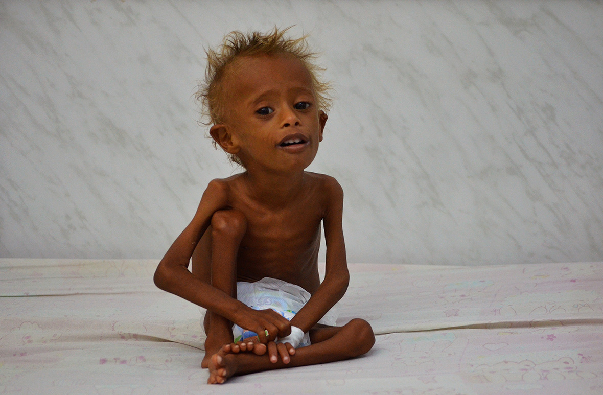 Yemen famine