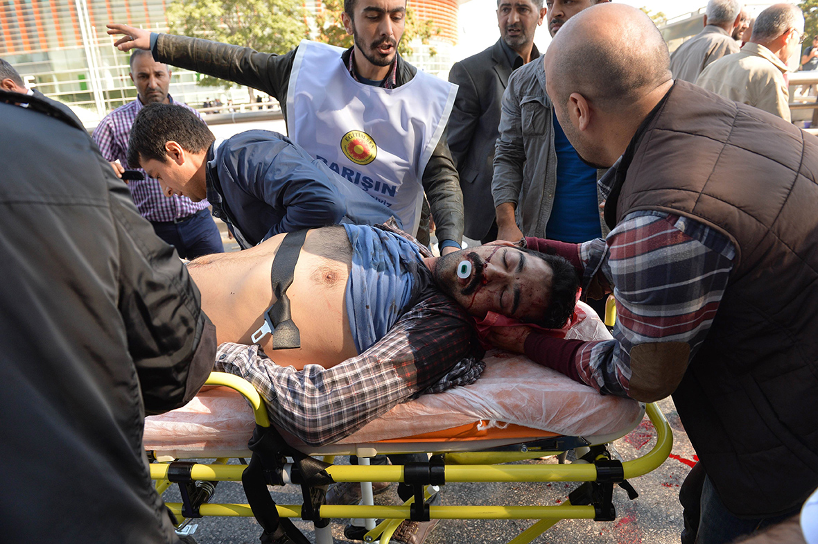 Ankara 2015 bombing