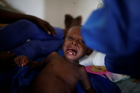A child is being treated at the cholera treatment center