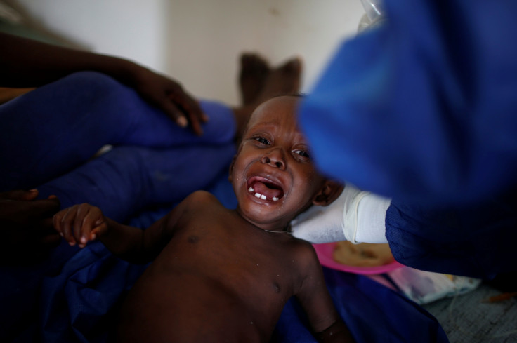 A child is being treated at the cholera treatment center