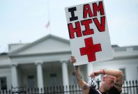 HIV AIDS US