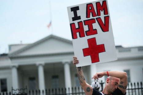HIV AIDS US