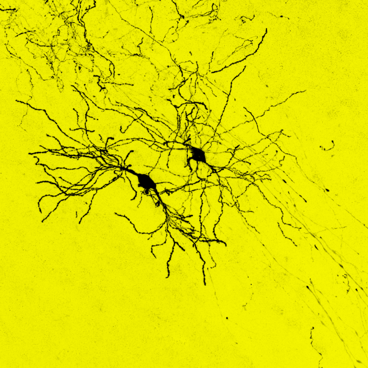 transplanted neurons