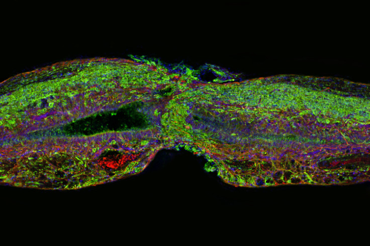 Zebrafish spinal cord